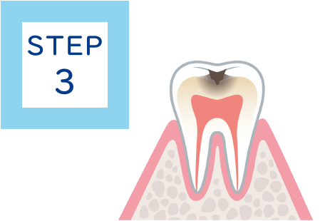 STEP3