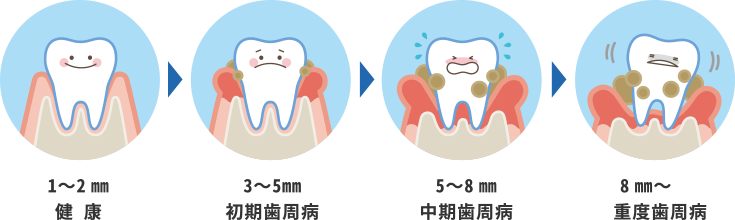 歯周病の目安